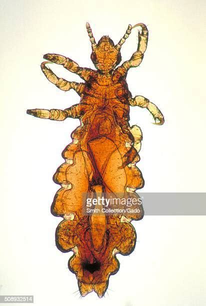 Human Body Lice Photos And Premium High Res Pictures Getty Images