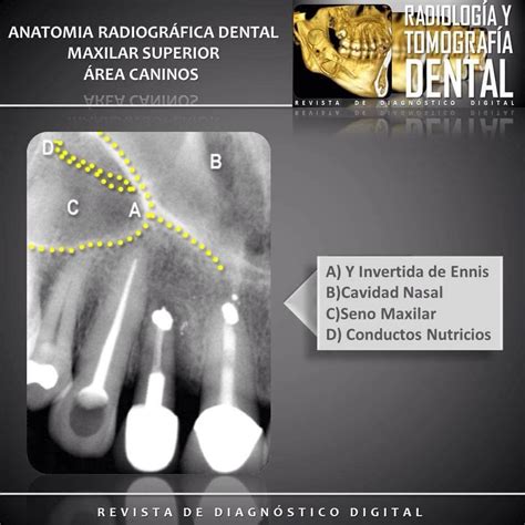Pin On Anatomía Radiológica Dental Maxilar Superior