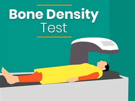 All You Need To Know About Bone Density Test