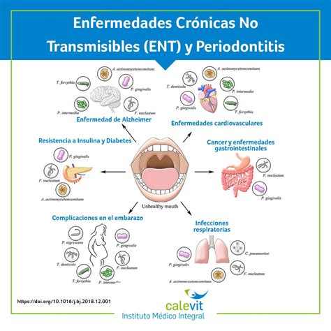 Enfermedades Crónicas No Transmisibles Ent Y Periodontitis Calevit