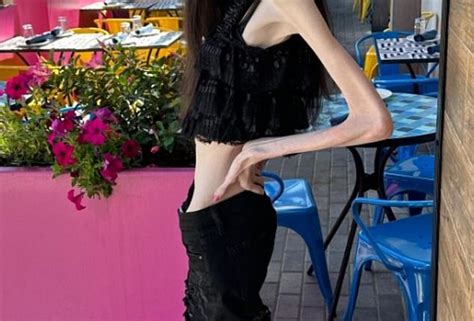 Anorexic Youtuber Eugenia Cooney Prompts Wave Of Serious Health Concerns After Showing Off