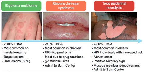 Episode 25 Skin And Skin Structure Infections Foamcast