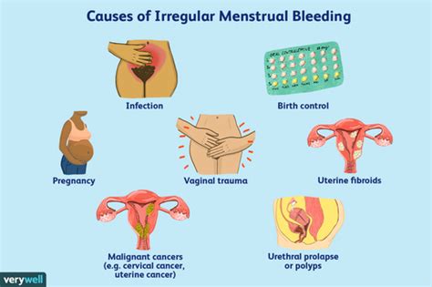 Warum Blutungen Oder Schmierblutungen Zwischen Den Perioden Auftreten