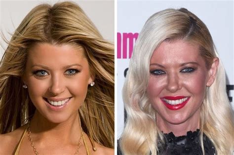 10 Celebs Who Regret Their Plastic Surgery Disasters