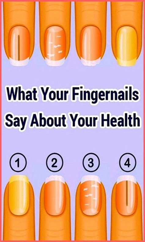 This Is What Your Fingernails Say About Your Health In 2020 Health