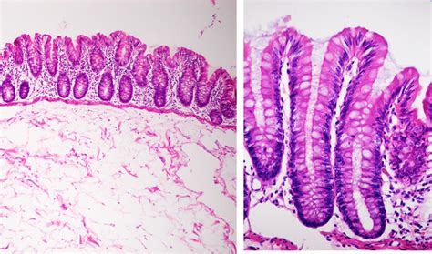 SOS BIOLOGIA CELULAR Y TISULAR DIGESTIVO Histology Of The Digestive