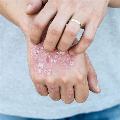 How Do I Know If I Have A Skin Allergy