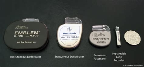 David rhine explains the differences between and functions of pacemakers and an defibrillator. Before and After a Pacemaker or Defibrillator Implant ...
