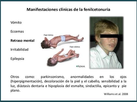 Pku Fenilcetonuria