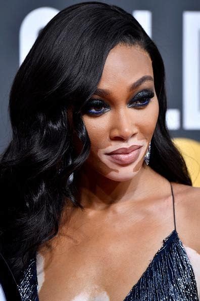 We Love The Gorgeous Winnie Harlow Look At Those Lashes Its A