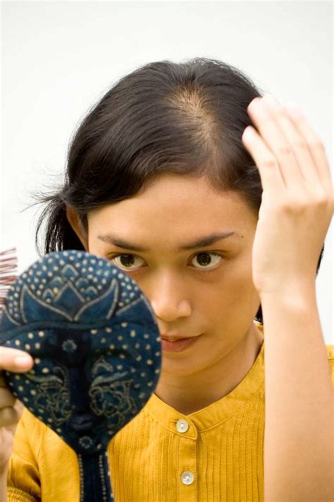 However, there are several types of anemia, each with its own if your diet is high in sugar, a diet/lifestyle change is the first and most important thing you can do to prevent hair loss caused by anemia. Iron deficiency hair loss: Symptoms, treatment, and regrowth