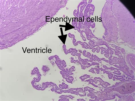 Ependymal Cell And The Choroid Plexus Histology