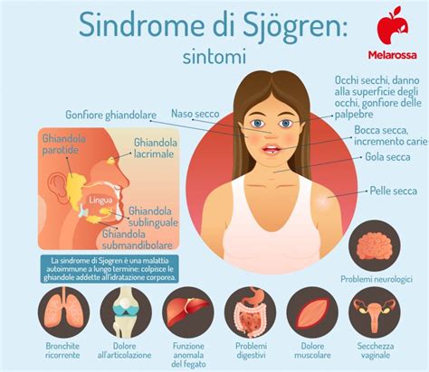 Sindrome di Sjögren cos è cause sintomi diagnosi e terapia