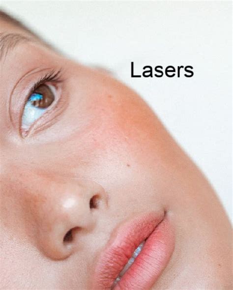 Lasers Skin By Design Dermatology And Laser Center Pa