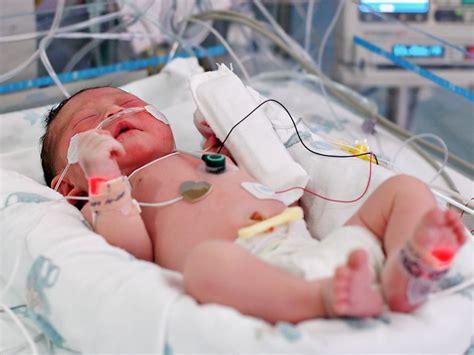 Following Guidelines May Prolong Neonatal Sepsis Treatment