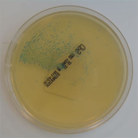 Streptococcus Agalactiae Group B Streptococcus On Chromid Cps Agar A Photo On Flickriver