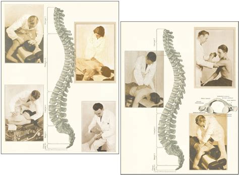 Chiropractic Adjustment Posters Clinical Charts And Supplies