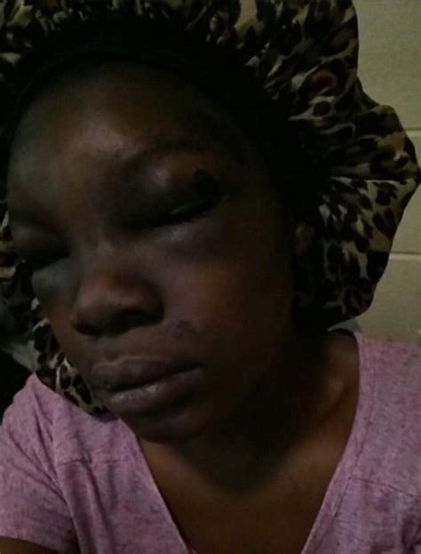 pregnant tennessee woman miscarries after brutal beating daily mail online