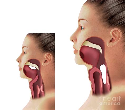 Throat Anatomy Photograph By Mikkel Juul Jensen Science Photo Library