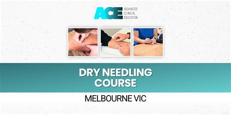 dry needling course melbourne vic humanitix