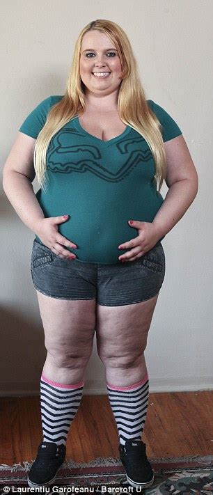 Meet The 23 Year Old Who Feeds Herself 5000 Calories Per Day Through A