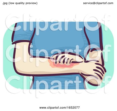 Girl Symptoms Itchy Skin Illustration By Bnp Design Studio 1652077