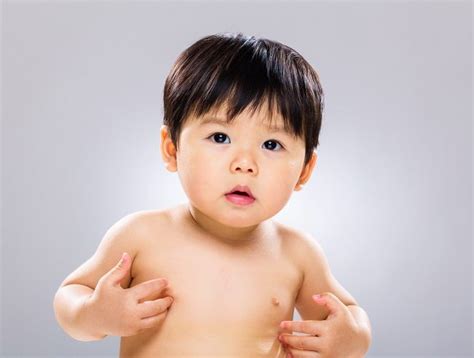 Mengetahui Cara Deteksi Dini Alergi Pada Anak Alodokter