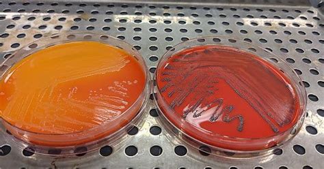 Listeria Innocua And Listeria Monocytogenes On Rapidl Mono Agar