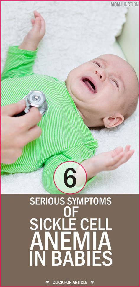 The signs and symptoms of sickle cell disease will vary from person to person and can change over time. 6 Serious Symptoms Of Sickle Cell Anemia In Babies