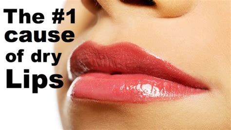 The Secret Causes Of Chapped Lips Its Not Lip Balm Deficiency