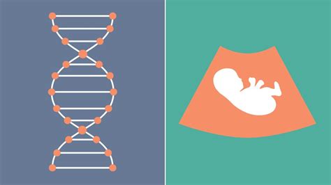 Down Syndrome Causes And Risk Factors