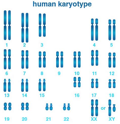 Karyotype Karyotype Test And Analysis Normal Karyotype And Abnormal Karyotype