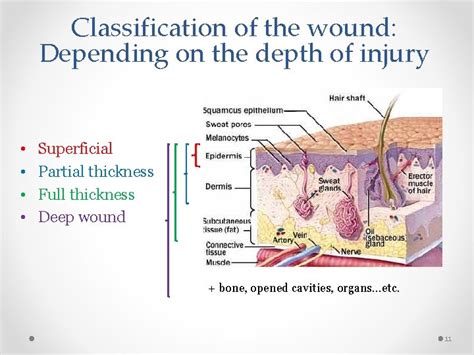 Wound Care And Suturing In The Emergency Department