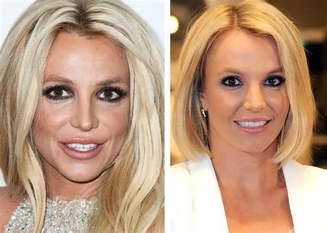Britney Spears Antes Y Despu S De La Cirug A Est Tica Verge Campus Peaceful Place