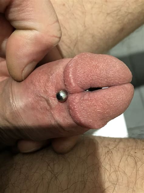 Penis Split Glans Cock Dick 13 Pics Xhamster