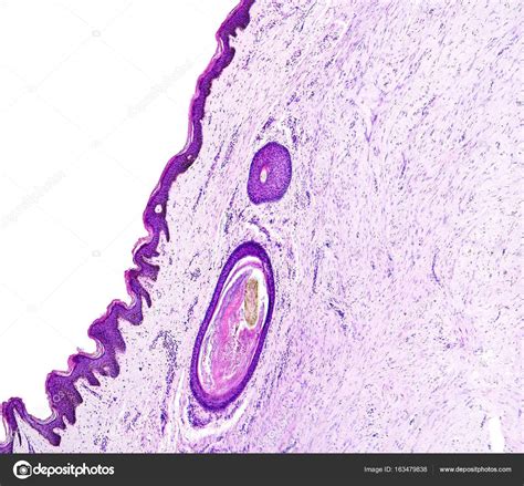 Histology Of Human Tissue Show Skin With Hair Follicles As Seen Under
