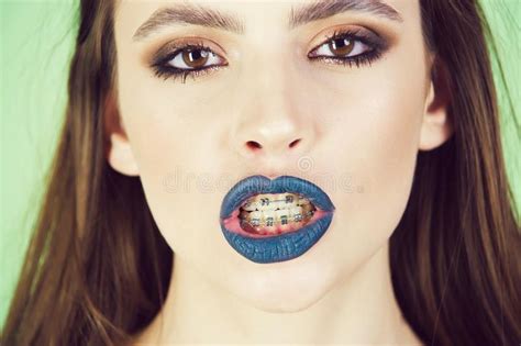 Dentist Services Happy Woman With Teeth Braces Grey Lips Fashionable