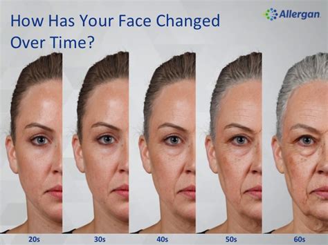 Facial Aging Hotch Laser Green Bay