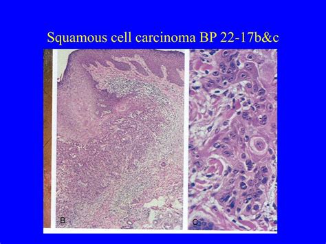 Ppt Skin Pathology Pigmented Lesions Neoplasms Immune Mediated