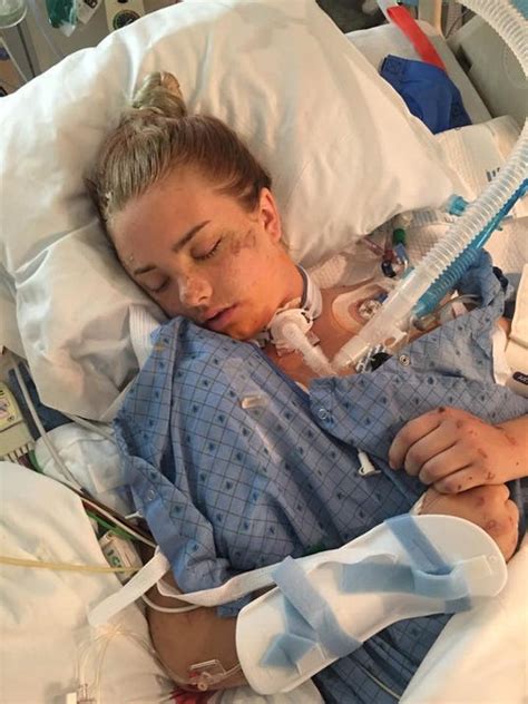 Teen Critically Injured In Crash Remains In Coma