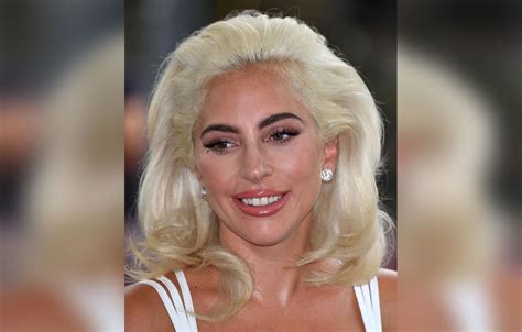 Lady Gagas Plastic Surgery Makeover Exposed By Top Docs