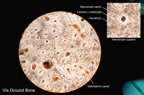 These are mostly compacted bone with little marrow and include most of the bones in the limbs. Osteon - Wikiwand