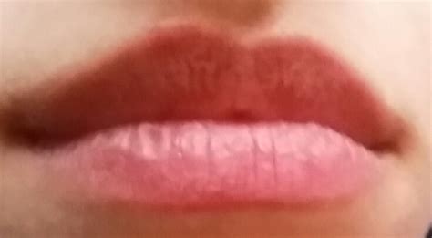 Beim rasieren geschnitten, dann is das getrocknete blut unbemerkt eingewachsen. KRIEGE ICH HERPES? (Lippe)
