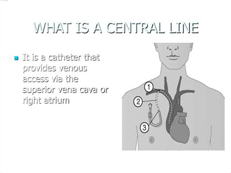 Ppt Central Lines And Arterial Lines Powerpoint Presentation Id149957