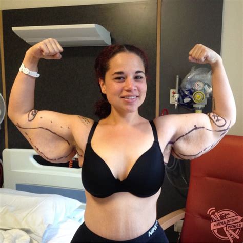 Meet The Woman Whose Extreme Weight Loss Left Her Needing
