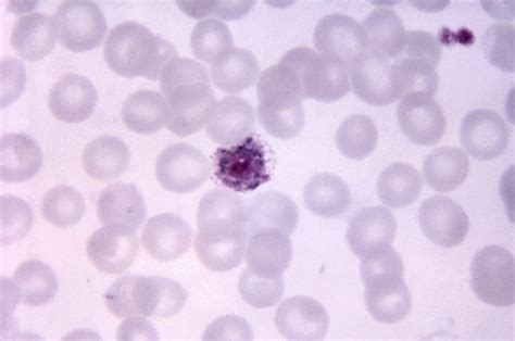 Free Picture Micrograph Plasmodium Vivax Microgametocyte Blue