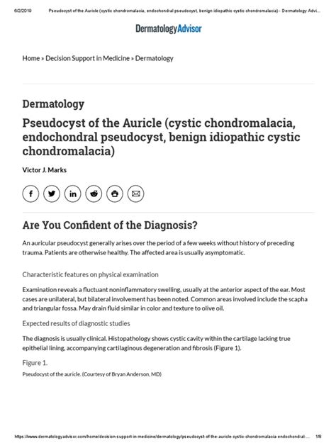 9 Pseudocyst Of The Auricle Cystic Chondromalacia Endochondral