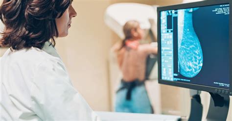 Predicting Cancer Risk From Mammograms Could Revolutionise Screening