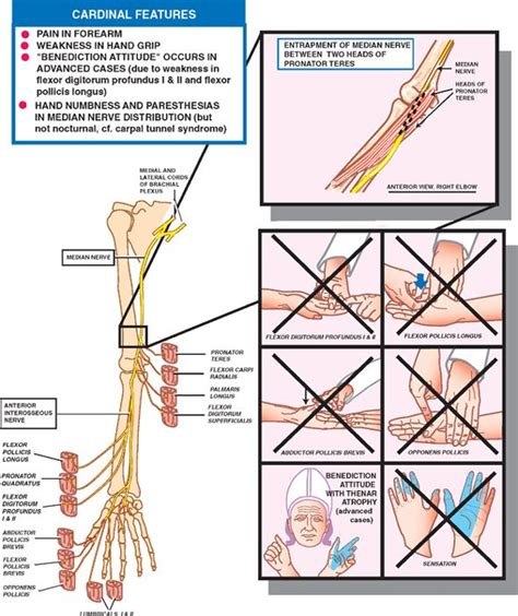 Peripheral Nerves Neupsy Key Peripheral Nerve Median Nerve Nerve