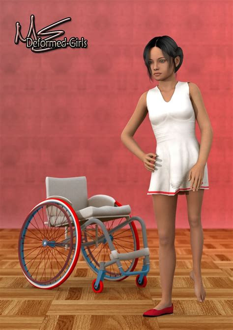 Disable Legs Deformed Feet Short Leg By Onefootbare1982 On Deviantart Short Legs Wheelchair